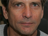 Dirk Benedict