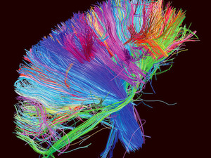 Muse: 'The 2nd Law' artwork