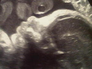 Shakira and Gerard Pique share ultrasound photo on Twitter.