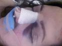 The presenter needs surgery after tumbling down a flight of stairs in heels.
