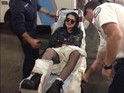 The singer required 60 stitches in her leg after falling on stage in Anaheim.