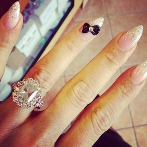 Who�d wear a ring like this? Guess the engagement ring